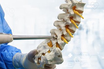 Endoscopic Lumbar Interbody Fusion