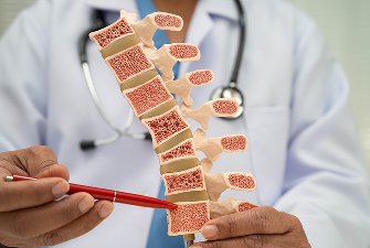 Facet Radiofrequency Ablation