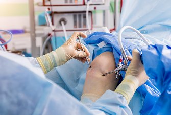 Intra Articular Intervention