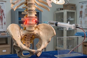 Lumbar Sympathectomy Surgery